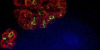 Probe Opens New Path for Drug Development Against Leading STD